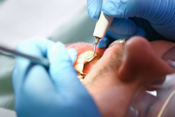 Best Pediatric Emergency Dentist in Oliver Springs, TN